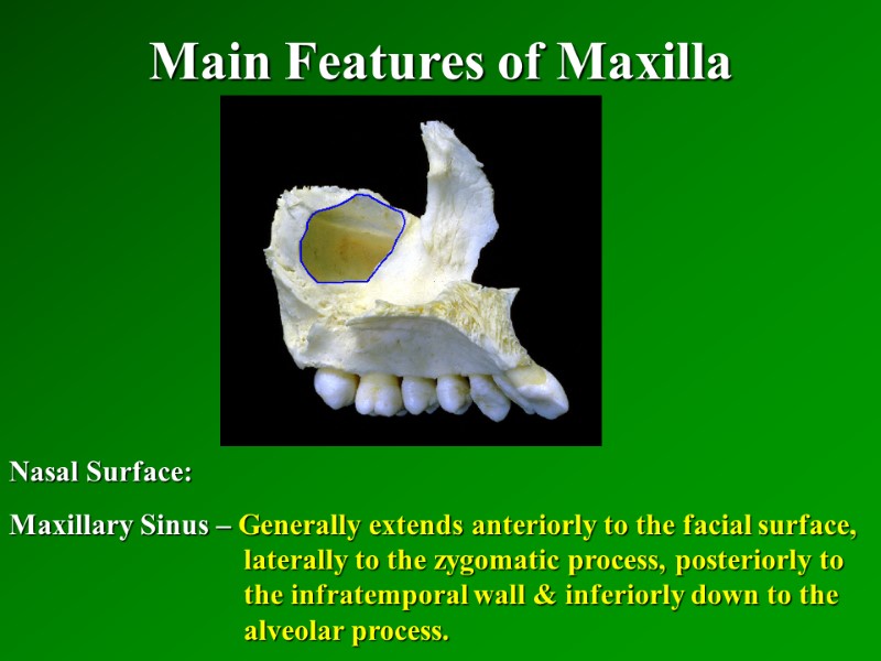 Main Features of Maxilla   Nasal Surface: Maxillary Sinus – Generally extends anteriorly